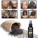 Hair Growth Serum - Black Rice Water Spray for Women & Men | Hair Loss Treatment with Castor Oil & Ginger | Thicker Fuller Healthier Hair - Buy Online on GoSupps.com