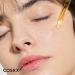 COSRX Post Acne Mark Recovery: Snail Mucin 92% + Vitamin C 23% Serum - Intensive Hydrating Treatment for Fine Lines & Hyperpigmentation - Buy Online on GoSupps.com