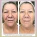Droplette Wrinkle Repair Refill Capsules | Anti-Aging Face Smoothing & Firming with Collagen & Retinol - Reduces Fine Lines & Wrinkles (28 Count - Buy Online on GoSupps.com