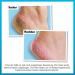 OKeeffe's Healthy Feet Foot Cream Tube - 80 ml | Intense Moisturizing Cream for Dry Cracked Feet - Buy Internationally - Buy Online on GoSupps.com