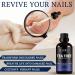 100% Pure Tea Tree Oil for Toenails - Natural Remedy for Skin & Foot Care | Melaleuca Alternifolia Essential Oil 1 Fl Oz - Buy Online on GoSupps.com