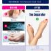 Effective Toe Separator & Stretcher for Bunions, Hammertoes & Crooked Toes | Universal Size, Latex-Free & PVC-Free - Buy Online on GoSupps.com