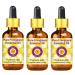 Deve Herbes Frangipani Essential Oil (Plumeria alba) with Glass Dropper Steam Distilled 100ml X 3 (Pack of Three) (10 oz)