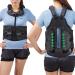 TODDOBRA TLSO Thoracic Full Back Brace for Men and Women - Universal Treat Kyphosis Compression Fractures Osteoporosis Upper Spine Injuries and Pre or Post Surgery with Hard Lumbar Support