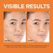 L'Oreal Paris Revitalift Vitamin C Serum with Vitamin E & Salicylic Acid - Moisturizing, Smoothing & Brightening Formula - Non-Greasy - Sample Size - Buy Online on GoSupps.com