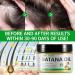 Raw Batana Oil for Hair Growth Natural Batana Oil Organic Cold Press Hair Oil for Men & Women 120G - Buy Online on GoSupps.com
