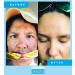 Admire My Skin Dark Spot Corrector Serum + Retinoid Cream Set - Buy Online on GoSupps.com