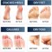 Exfoliating Foot Peel Mask for Baby Soft Feet - Dermatologically Tested, 2 Pairs (up to Size 12) - Buy Online on GoSupps.com