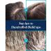 Esthetic House CP-1 Scalp Scaler (250ml): Deep Cleansing Scalp Scrub for Scalp Relief - Buy Online on GoSupps.com