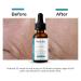 Rinela Skin C E ferulic serum Advanced Antioxidant Formula 20% L-Ascorbic Acid 1.01 fl oz - Buy Online on GoSupps.com