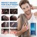 Best Eczema & Psoriasis Shampoo | Seborrheic Dermatitis & Scalp Treatment - International Shipping - Buy Online on GoSupps.com