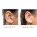 Rave High Fidelity Ear Plugs - Premium Hearing Protection for Concerts & Music | Noise Reducing Earplugs - Tinnitus Relief (2 Pairs Black Case 19/25 dB - Buy Online on GoSupps.com