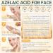 Azelaic Acid 14% for Face Premium Acne Cream Reduces Dark Spots & Facial Redness Azelaic Acid Serum with Salicylic Acid & Niacinamide for Acne Breakouts Oil Control & Relieve Irritation 1 Oz 1 Fl Oz (Pack of 1) - Buy Online on GoSupps.com