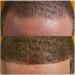 HAIR FUSION - Real Human Hair Fibers for Baldness & Thinning Hair - Root Touch Up, Volumizer - Unisex (Jet Black 1.05 oz) - Buy Online on GoSupps.com