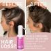 Remixidil Minoxidil 2% Hair Growth Spray for Women - Thinning Hair Regrowth & Thickening Treatment | Fast International Shipping - Buy Online on GoSupps.com