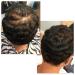 HAIR FUSION Dark Brown: 100% Real Human Hair Fibers for Baldness & Thinning - Root Touch Up, Volumizer - Unisex (1.05 oz) - Buy Online on GoSupps.com