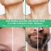 Titanium Derma Roller - 0.25mm Microneedler for Face & Beard Skincare - Buy Online on GoSupps.com