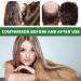 Raw Castor Oil for Hair Growth 120ml Castor Oil Pure Butter Hair Conditioner for Damage Protective Moisture Recovery Miracle Oil for Healthier Thicker Fuller Hair - Buy Online on GoSupps.com