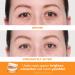 Peter Thomas Roth | Full-Size Vitamin C & Hyaluronic Eye Patches 2-Piece Kit 1 Count (Pack of 2) Clear - Buy Online on GoSupps.com