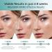 Abera Suero Melasma - Tratamiento con Niacinamida & Hidroquinona para Manchas Oscuras - 20ml | Mejora tu Piel Hoy - Buy Online on GoSupps.com