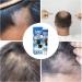  Yhsioaklo Care Hair Loss Cream | Hair Growth Oil | 20g Repair Cream for Hair Loss | Anti-Alopecia Serum - Buy Online on GoSupps.com