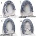 Soft Thicker Warmer Toilet Seat Cover with Snaps - Gray | Easy Installation & Cleaning - Buy Online on GoSupps.com