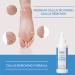 ForPro Premium Callus No More! Callus Remover - Fast-Acting Formula - 4 oz - Buy Online on GoSupps.com