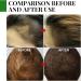 Rosemary Essential Oil For Hair Strenghten And Anti-Hair Loss Rosemary Hair Oil Hair Growth Oil Pure & Natural Nourishes Scalp Stimulates Hair Growth Lmprove Blood Circulation Vegan - Buy Online on GoSupps.com
