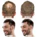 Derma Roller Microneedle Roller for Face Body Beard Hair Growth - 3 Pack Titanium Needles for Home Use - Buy Online on GoSupps.com