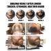Beard Growth Kit with Roller, Oil, Brush & More - Christmas Gift for Men - Buy Online on GoSupps.com