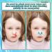 50 Pcs Stop Nosebleeds Clip - Nasal Stopper for Kids & Adults - Emergency Accidents - Blue/Green - Buy Online on GoSupps.com