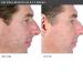 PMD Beauty Personal Microderm Man - Black 390g | Enhance Your Skin's Radiance - International Shipping Available - Buy Online on GoSupps.com