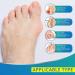 Vicorrect Bunion Corrector - Orthopedic Bunion Splint for Big Toe Pain Relief - Buy Online on GoSupps.com