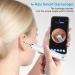 Wireless Ear Wax Removal Otoscope 3.9mm | 6 LED Lights, Waterproof | iOS & Android Compatible | For Adults, Kids, Pets - White - Buy Online on GoSupps.com