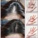 LINXINS Batana Oil for Hair Growth Raw Batana Oil Batana Oil Organic Botana Oil Repairs Damaged Hair Reduces Hair Loss - Miracle Oil for Healthier For Hair Growth (1PC - 120ml) - Buy Online on GoSupps.com