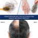 Alopecia Cr me de croissance des cheveux p te capillaire naturelle cr me paississante des cheveux formule naturelle pratique compacte 20 g pour homme et femme adulte - Buy Online on GoSupps.com