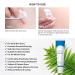 Aroamas Scar Gel - Professional Grade Advanced Scar Removal Treatment 1.06 oz - Buy Online on GoSupps.com