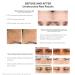 Murad 30 Day Brightening Kit - Vitamin C Essential-C Cleanser, Vita-C Glycolic Serum, Day Moisture SPF 30, Eyes Dark Circle Treatment - 5-Piece Trial-Size Kit (90 Value) - Buy Online on GoSupps.com