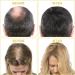 Hair Growth Oil Serum for Men & Women - Prevent Hair Loss, Enhance Natural Growth, Repair Damaged Scalp - 60ml - Buy Online on GoSupps.com