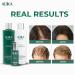 ALIKA Hair Growth Set - Shampoo, Conditioner, Serum for Women & Men - 22.93 oz - Suitable for Dry, Oily, and Normal Scalp - Buy Online on GoSupps.com