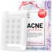 LE GUSHE Acne Patches 132 Dots 3 Sizes 8 mm, 10 mm, 12 mm - Hydrocolloid Pimple Patches Blemish Protective Cover Absorbing Spot Treatment Hydrocolloid Dressing Zit Sticker Healing Dot