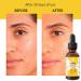 Relaxcation Lemon Seed Oil | Cold Pressed Citrus limon Seed Extract for Face Hair & Skin | 100% Unrefined Vegan Hexane-Free Glow Oil | Amber Glass Travel Size (0.5 oz) 0.5 Fl Oz (Pack of 1) - Buy Online on GoSupps.com