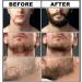 Complete Beard Growth Kit for Men - Beard Roller, Wash, Serum, Oil, Balm, Brush, Comb, Scissor, eBook - Perfect Beard Grooming and Care Gift Set - Buy Online on GoSupps.com