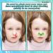 60 Piece Green Plastic Foam Nose Stop Clips for Emergency Use - Buy Online on GoSupps.com