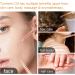  Frovetani 2 Pack Turmeric Serum for Dark Spot Removal Dark Spot Correction Oil Face and Body Serum Oil Natural Turmeric Oil for Fights Acne Skin - Buy Online on GoSupps.com