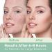 Large Hydrocolloid Pimple Patches - Tea Tree Oil Acne Spot Treatment for Face & Body - Buy Online on GoSupps.com