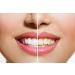 Organic Teeth Whitening | Natural Tooth Whitener for Bright White Teeth | 30g - Buy Online on GoSupps.com