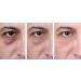 Anti-Aging Eye Gel for Dark Circles, Puffiness, Wrinkles & Skin Firming - Hyaluronic Acid & Aloe Vera - 1.7 fl. oz - Buy Online on GoSupps.com