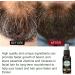 Fulenyi Beard Growth Kit - 30ml Beard Care Set for Men | Derma Roller Serum Oil & Balm - International Shipping Available - Buy Online on GoSupps.com