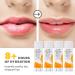 Beekeeper s Favorite Lip Balms 4 Pack | All Natural Beeswax & Manuka Honey Lip Care | Vitamin E Flavored Lip Balm for Dry Chapped Lips - Buy Online on GoSupps.com
